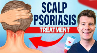 Say Goodbye to Psoriasis: Discover the Latest Effective Treatments That Americans Trust